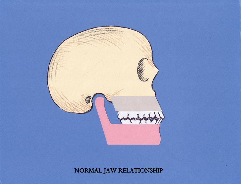 Normal jaw relationship
