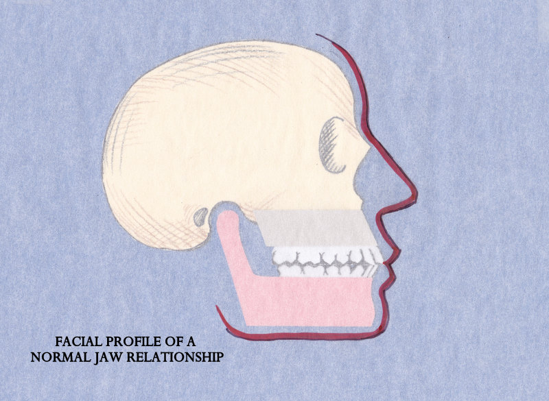 Bite and Normal jaw (2)